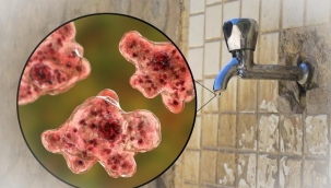 Beyin yiyen amip nedir, belirtileri neler? Beyin yiyen amip nasıl bulaşır, Türkiye’de var mı?