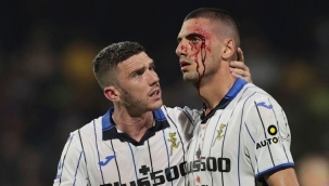 Merih Demiral'ın kaşı açıldı