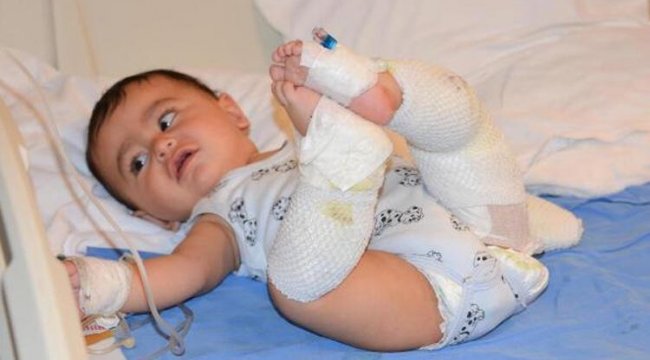Çaydanlık üzerine devrildi, 10 aylık bebek yaralandı