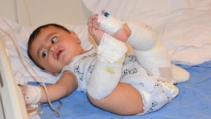 Çaydanlık üzerine devrildi, 10 aylık bebek yaralandı