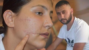 Eşini 104 yerinden bıçaklayan sanığa 20 yıl hapis istemi