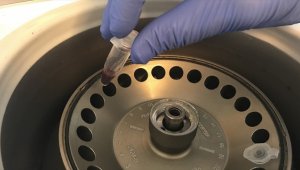 Serebral palsi tanısı için 'genetik test yaptırın' uyarısı