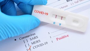 Türkiye'de 28 bin 370 kişinin testi pozitif çıktı, 196 kişi hayatını kaybetti