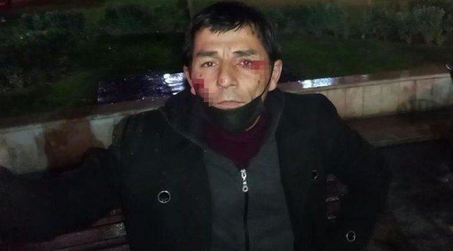 Dehşete düşüren olay! Tacize uğrayan kadını kurtarmak isterken canından oluyordu