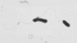 ERÜ Kampüsünde Yaşayan Gelengilerden Yeni Bir Bakteri Türü Keşfedildi