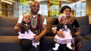 İstanbul'da ayrılan Kamerunlu siyam ikizlerin ailesinden Türkiye'ye teşekkür