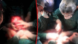 Kilo şikayetiyle gitti, gerçek çok farklı çıktı! Doktorlar da şaşırdı