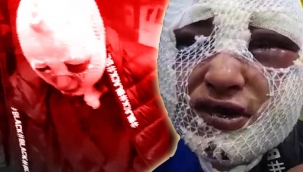 Vahşet! Eski sözlüsüne cinsel saldırıda bulunup başından aşağı kızgın yağ döktü