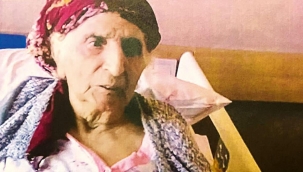 Yanlış bacak ameliyatı