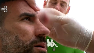 Survivor Hikmet sakatlandı! Hikmet'in gözüne ne oldu, sakatlığı nedir? Hikmet yarışmaya veda mı ediyor?