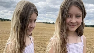 Bir gün sarışın bir gün esmer! Saçını boyamıyor, nadir bir hastalığa sahip...