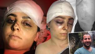 Sultangazi'de dehşet! Tayt giydiği için bu hale geldi, saldırgan serbest bırakıldı