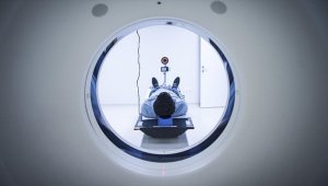 Kovid-19 geçirenlerin beyin boyutunda küçülme gözlemlendi