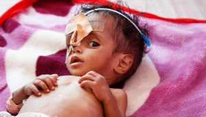 Rusya-Ukrayna savaşının etkileri Yemen'deki gıda krizini daha da ağırlaştıracak