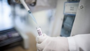 Dünyada her yıl 20 bin hemofili hastası doğuyor