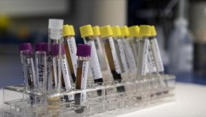 İngiltere'deki gizemli hepatit virüsü Avrupa ve ABD'de yayılmaya başladı