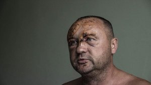 Ukrayna'da Rusların vurduğu alışveriş merkezinde yaralananlar yaşadıklarını anlattı