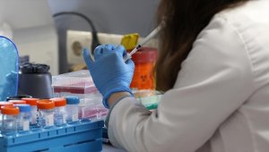 DSÖ'ye göre dünya genelinde maymun çiçeğinden 3 kişi öldü