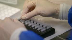 Gizemli hepatit vakalarına 'adeno-ilişkili virüsün' neden olduğu öne sürüldü