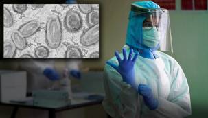 Maymun çiçeği vakalarında korkutan artış: Son iki haftada üçe katlandı