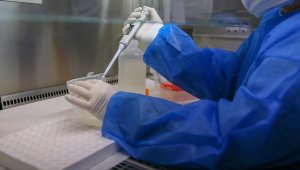 Rusya'da ilk maymun çiçeği vakası tespit edildi