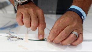 Tıkanan aort damarı geliştirilen sistemle kasıktan girip temizlenecek