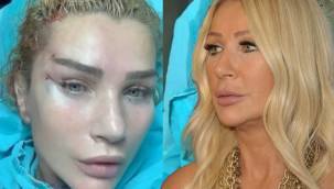 Estetik bağımlısı Seda Sayan ayarı kaçırdı! Bakın gençleşeyim derken ne oldu?