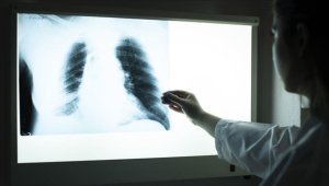 DSÖ: Tüberküloz vakaları yıllar sonra artışa geçti