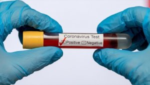 Altın Küre Ödül Töreni'ne katılan çok sayıda ünlü Kovid-19'a yakalandı