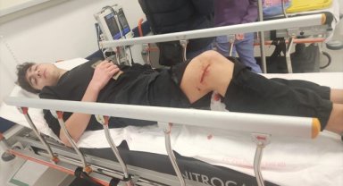 Ankara'da bir öğrenci daha okula giderken sahipsiz köpeklerin saldırısına uğradı