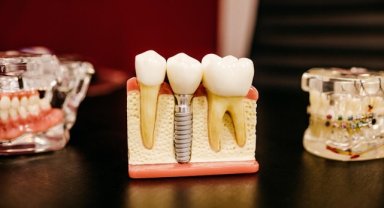 Dental turizmin 2023 beklentisi 300 milyon dolar