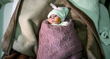 Filistinli 3 günlük bebek şah damarına yapılan müdahaleyle hayata tutundu