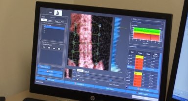 Kadınlarda kemik kırıklarının nedeni osteoporoz polikliniğinde araştırılıyor