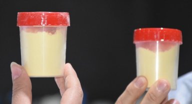 Kırık veya tarihi geçmiş yumurtalar akvaryum balıklarının yemine katkı maddesi oluyor 