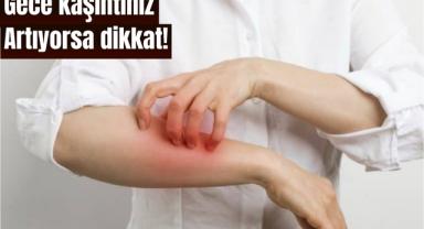 Her kaşıntı uyuz belirtisi midir?