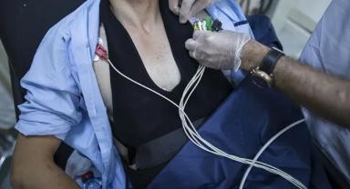 Aort diseksiyonu nedir, nasıl tedavi edilir