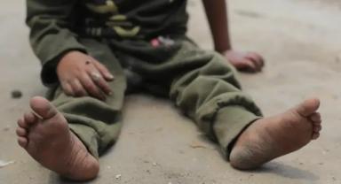 İngiltere'ye Gazzeli Çocukların Tedavisini Reddettiği İçin Dava Açıldı