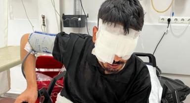 Ramazan Teker’in Aracına Kurt Çarptı, Takla Attı