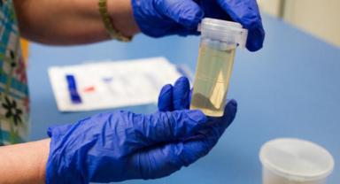 Kanda ve Saçta Uyuşturucu Madde Tespit Süreleri Nedir?