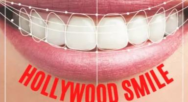 Hollywood Gülüşü Tartışması