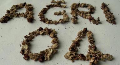 Ağrı’da Bir Böbrekten Tam 295 Taş Çıkarıldı