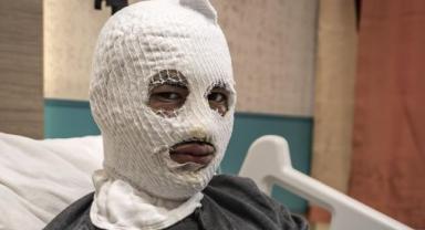 Küçük Hata, Büyük Tehlike: Erzurum’da 19 Yaşındaki Genç Yaralandı