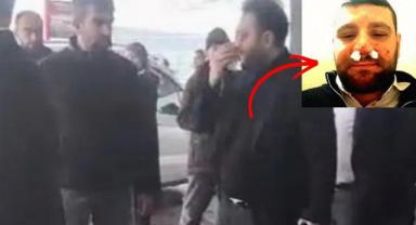 Otopark Magandaları Hukuk Tanımadı: Avukatın Burnunu Kırdılar!