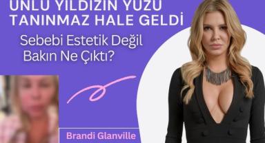 Ünlü Yıldızın Yüzü Tanınmaz Hale Geldi: Sebebi Estetik Değil Bakın Ne Çıktı?
