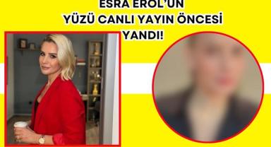 Esra Erol’un Yüzü Canlı Yayın Öncesi Yandı!