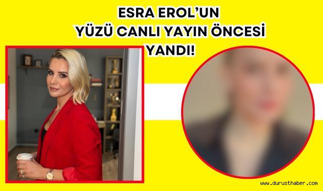 Esra Erol’un Yüzü Canlı Yayın Öncesi Yandı!