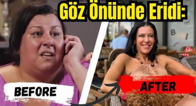 Göz Önünde Eridi: 10 Yıllık Büyük Değişim!