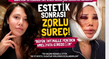 Didem Ceran’ın Estetik Kabusu! Yeniden Ameliyat Olacak