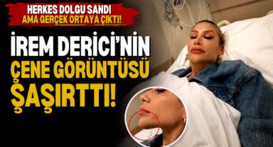 İrem Derici: Böyle Dolgumu Olur Külah Gibi