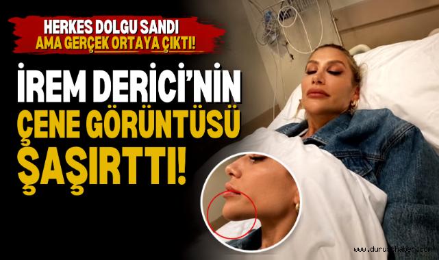 İrem Derici: Böyle Dolgumu Olur Külah Gibi